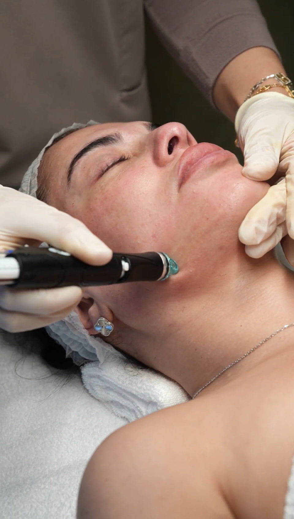HydraFacial at Aura Skin Boutique, Essendon